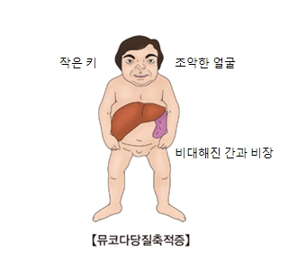 헌터증후군